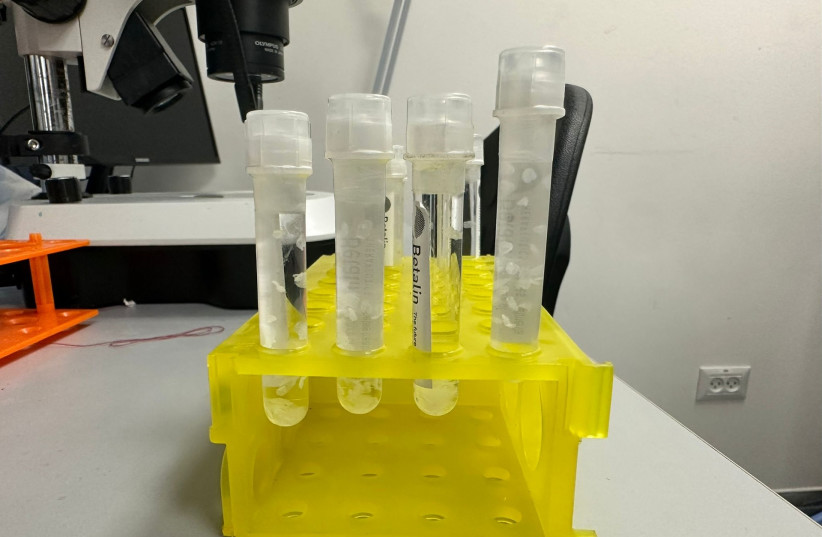The cleaned scaffold is kept in a tube. Eventually, beta cells will be implanted into the scaffold and inserted subcutaneously, serving as a micro pancreas to manage insulin production (credit: HANNAH LEVIN/THE MEDIA LINE) The cleaned scaffold is kept in a tube. Eventually, beta cells will be implanted into the scaffold and inserted subcutaneously, serving as a micro pancreas to manage insulin production (credit: HANNAH LEVIN/THE MEDIA LINE)