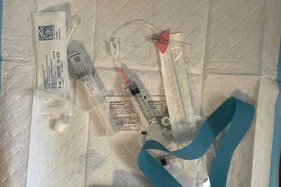 Stem cells just before injections. The procedure eliminated Nate Eckman’s pain within weeks. Photo courtesy of the author.